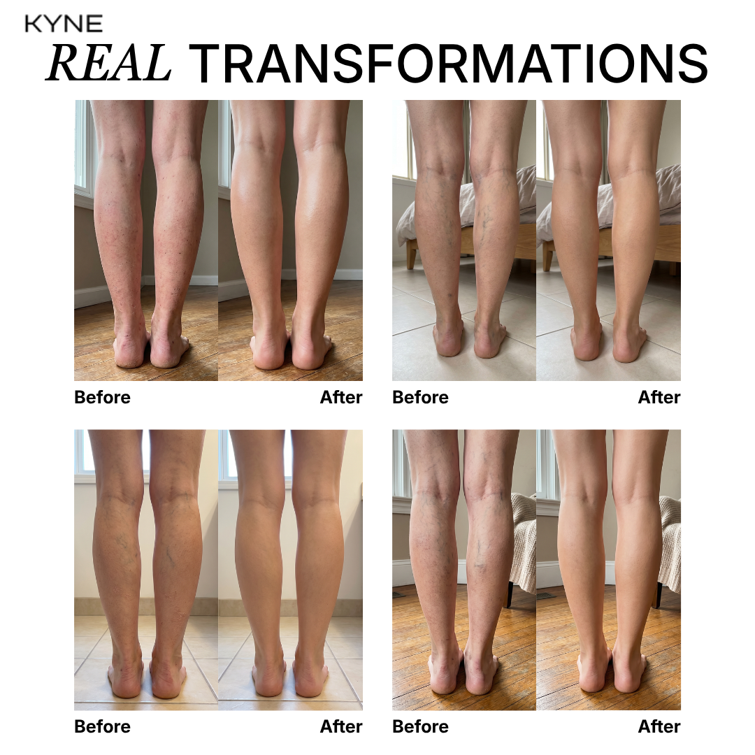 Kyne Skin-Perfecting Body Foundation