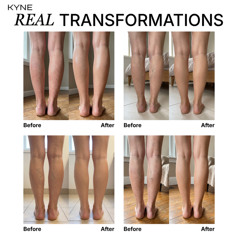 Kyne Skin-Perfecting Body Foundation