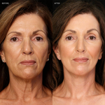 Color Changing Foundation